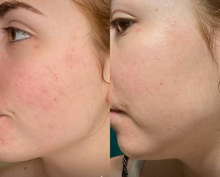 des clientes recommandent ce cleanser