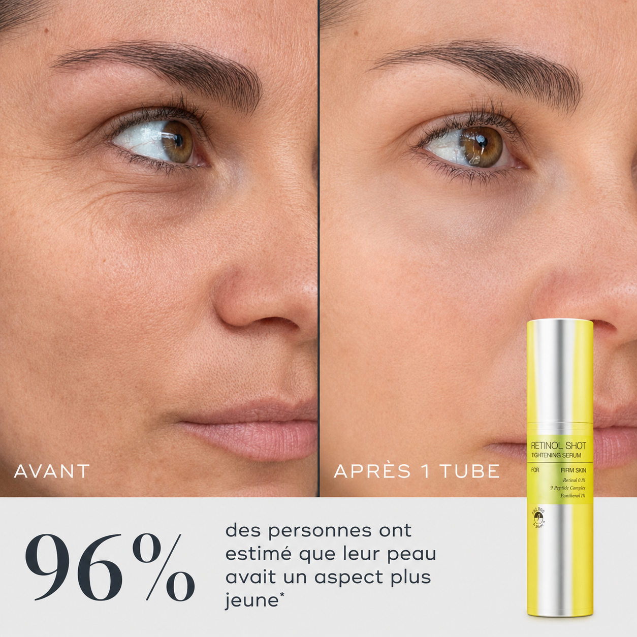 The Vita-A Retinol Shot Tightening Serum