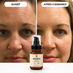Lotion hydratante anti-âge Keratin Queen