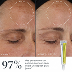 The Vita-A Retinal Shot Tightening Booster